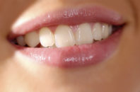 Close up photo of smiling woman's mouth and teeth.